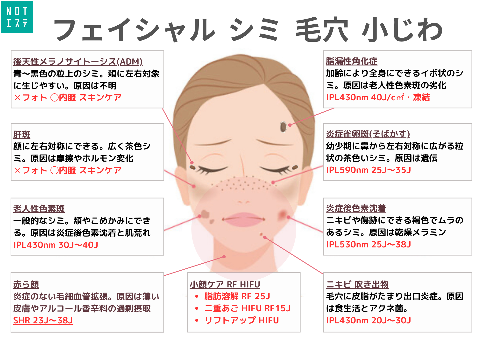 シミの種類と対策】シミの見分け方で施術が決まる【2024保存版】 - Not 